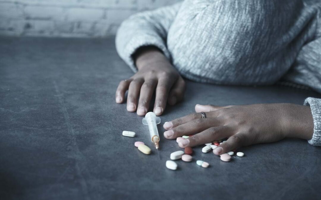 Do you need detox to quit oxycodone safely?